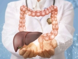 STATO DELL'ARTE SULLA MALATTIA DIVERTICOLARE ATTUALI ORIENTAMENTI NEL MANAGEMENT DELLE PATOLOGIE EPATICHE